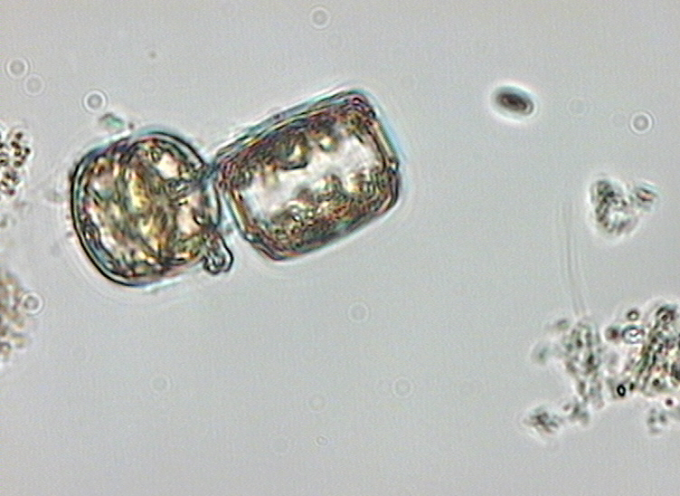 Dictyocha speculum